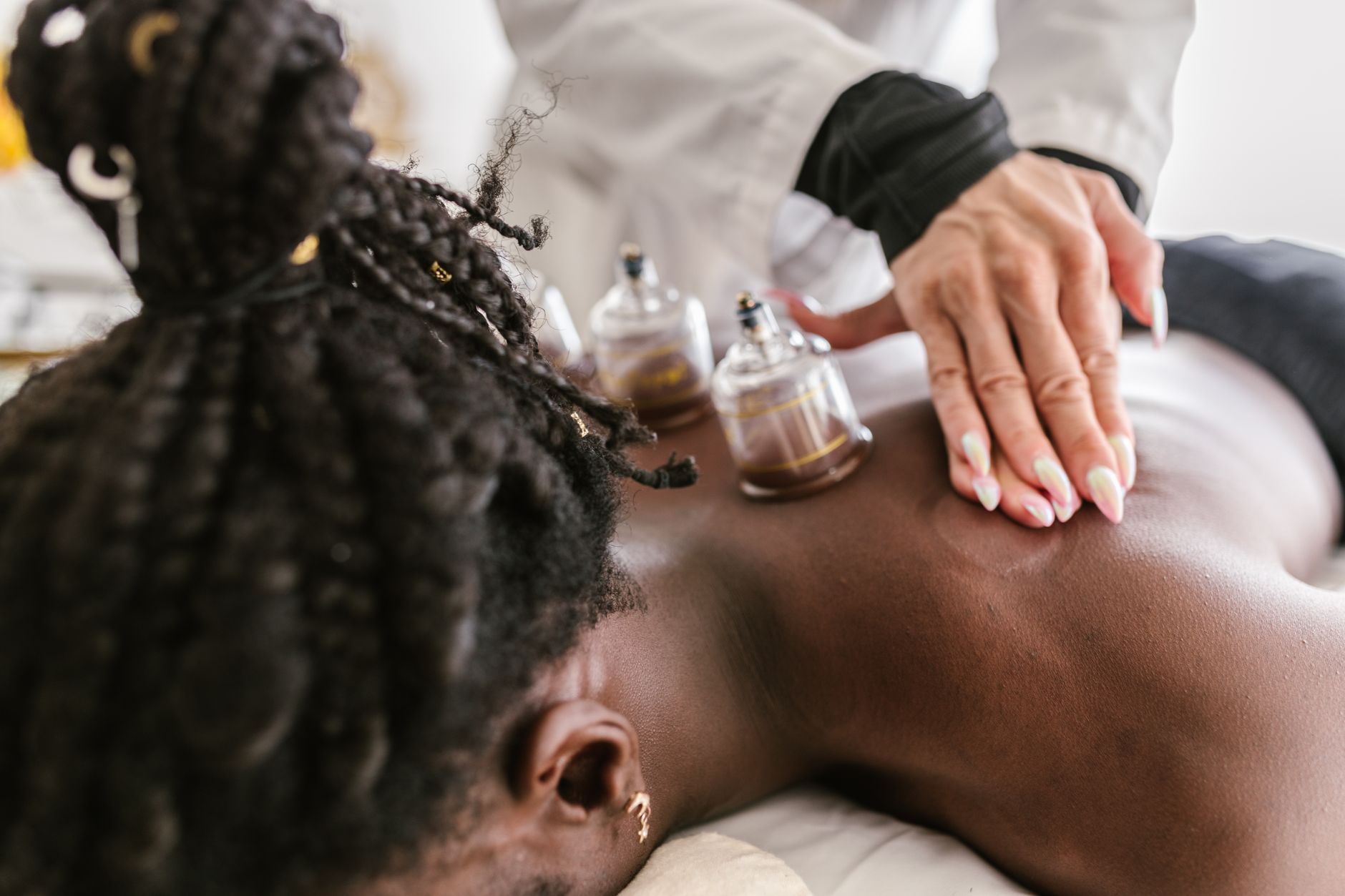 A practitioner placing round glass cupping cups in a row along a person&rsquo;s bare back during a dry cupping treatment session