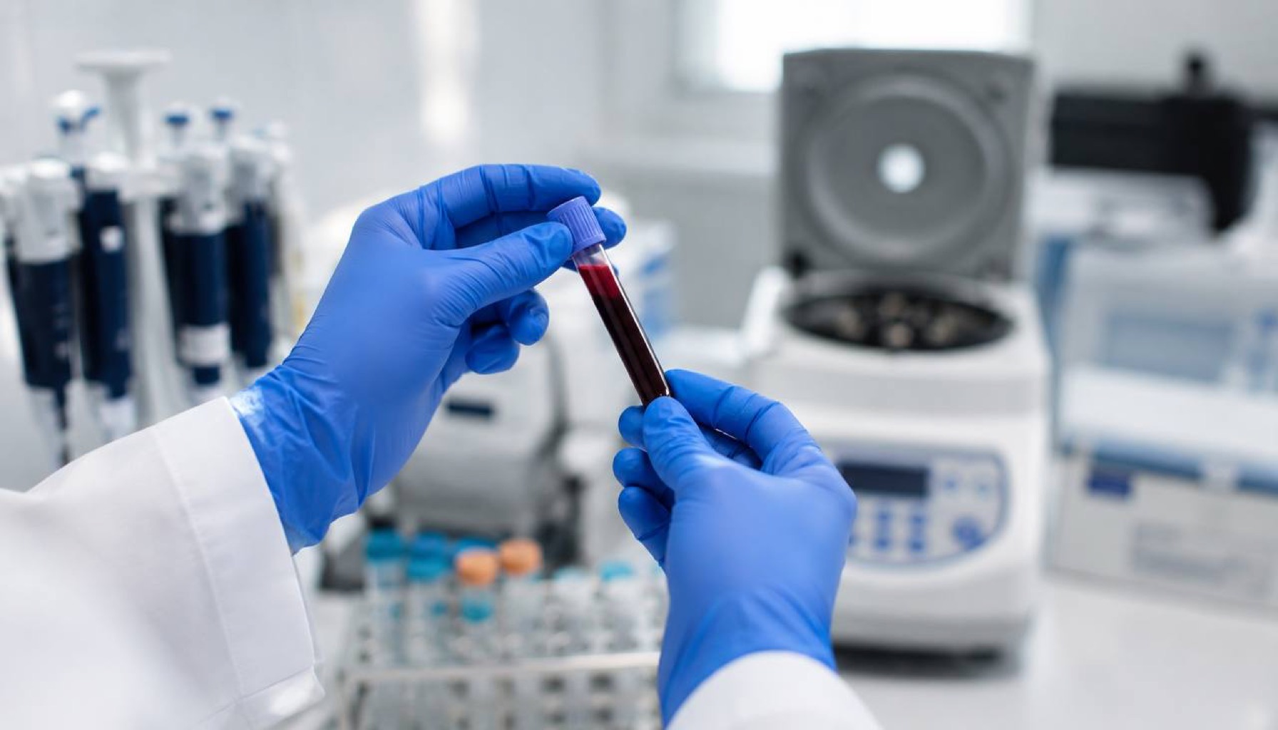 Laboratory researcher in blue gloves holding blood sample tube — GLP-1 receptor genetics and pharmacogenomics testing