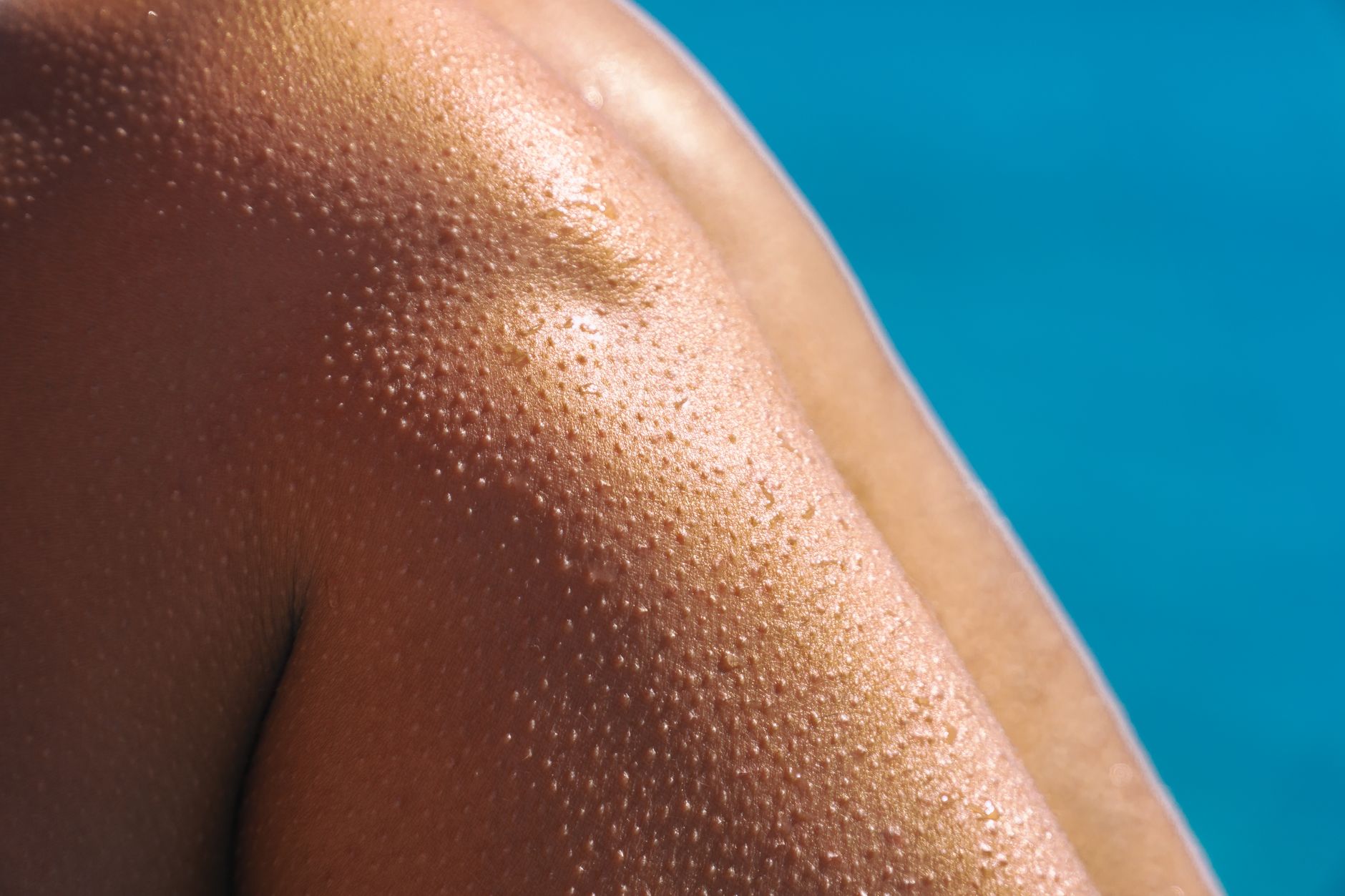Close-up of a person's sun-reddened bare shoulder beaded with water at a pool, skin texture and pores clearly visible in bright daylight