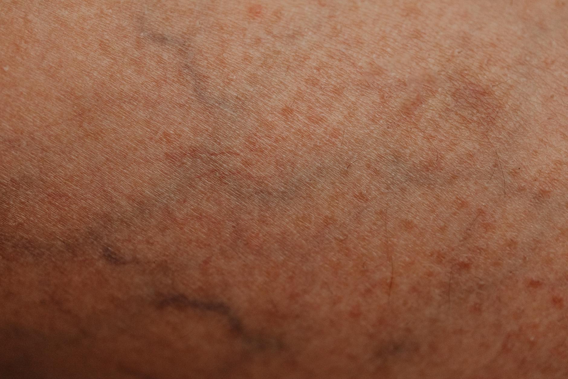Close-up of mature skin texture in natural light — skin aging collagen